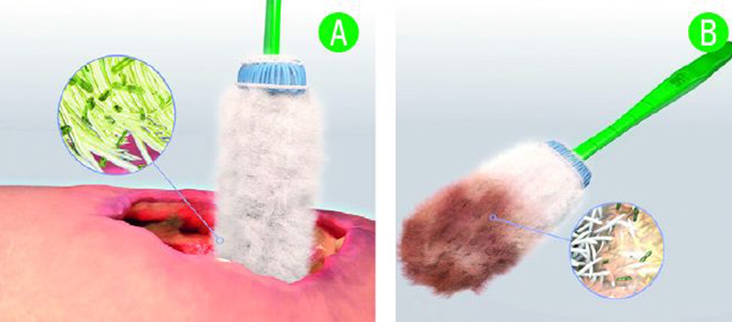 لولی دبریسافت (Debrisoft Lolly)
