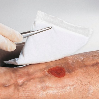 Wound Dressing